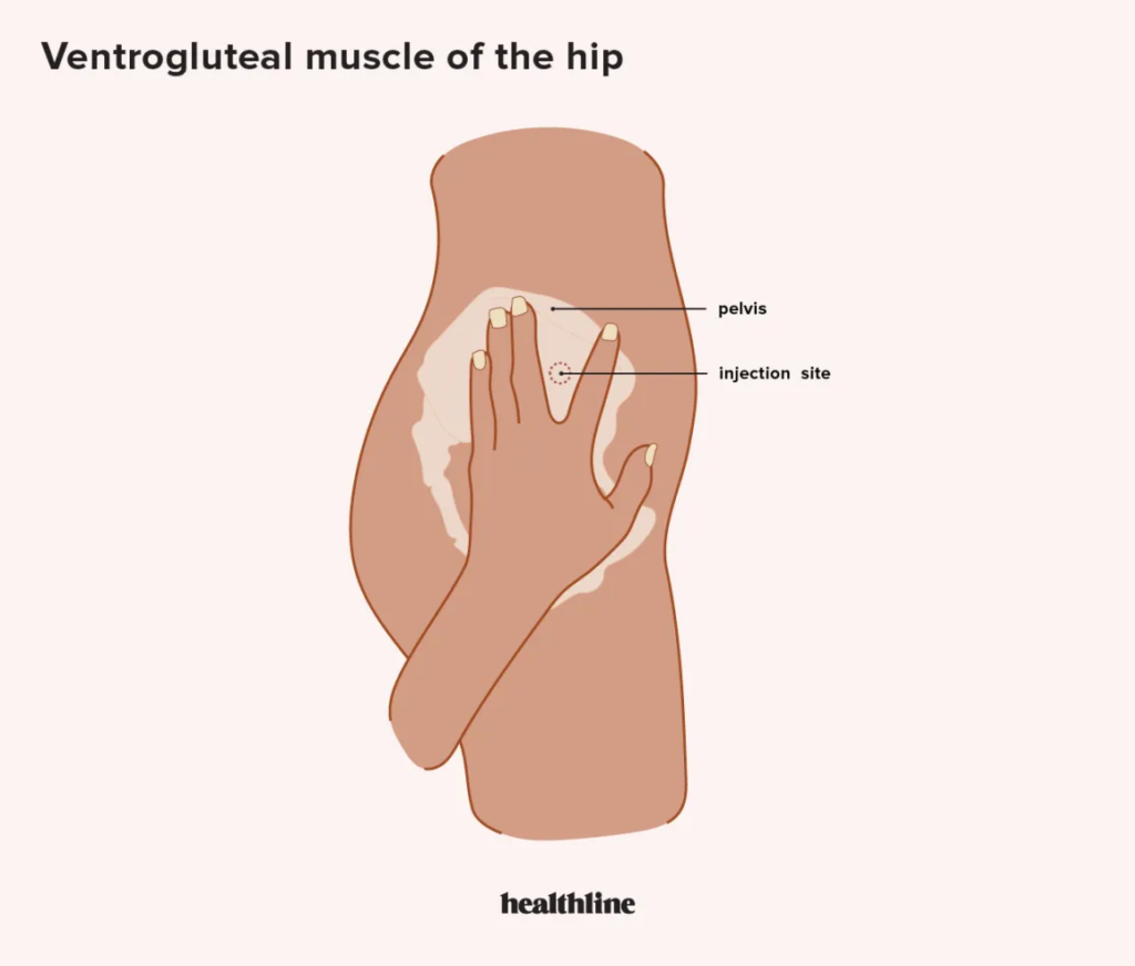 TRT Injection site on the hip
