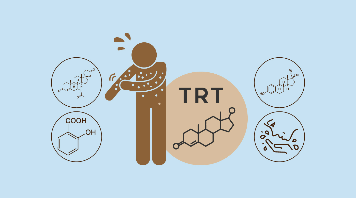 TRT And Acne Causes, Cures, Treatments 2024