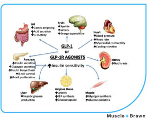 Should I count net carbs or total carbs on a ketogenic diet?