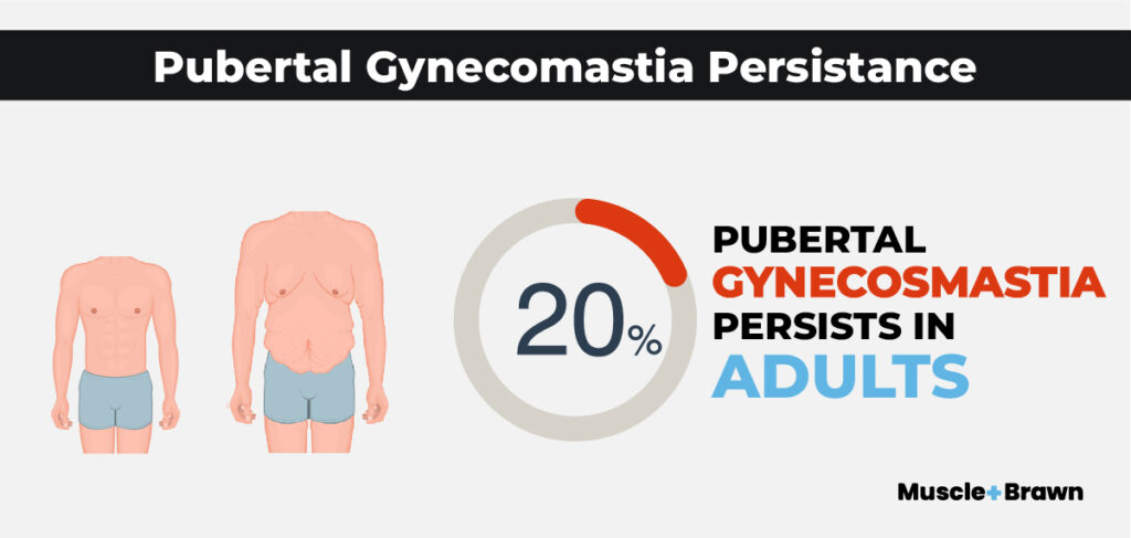15 Ghastly Gynecomastia Statistics