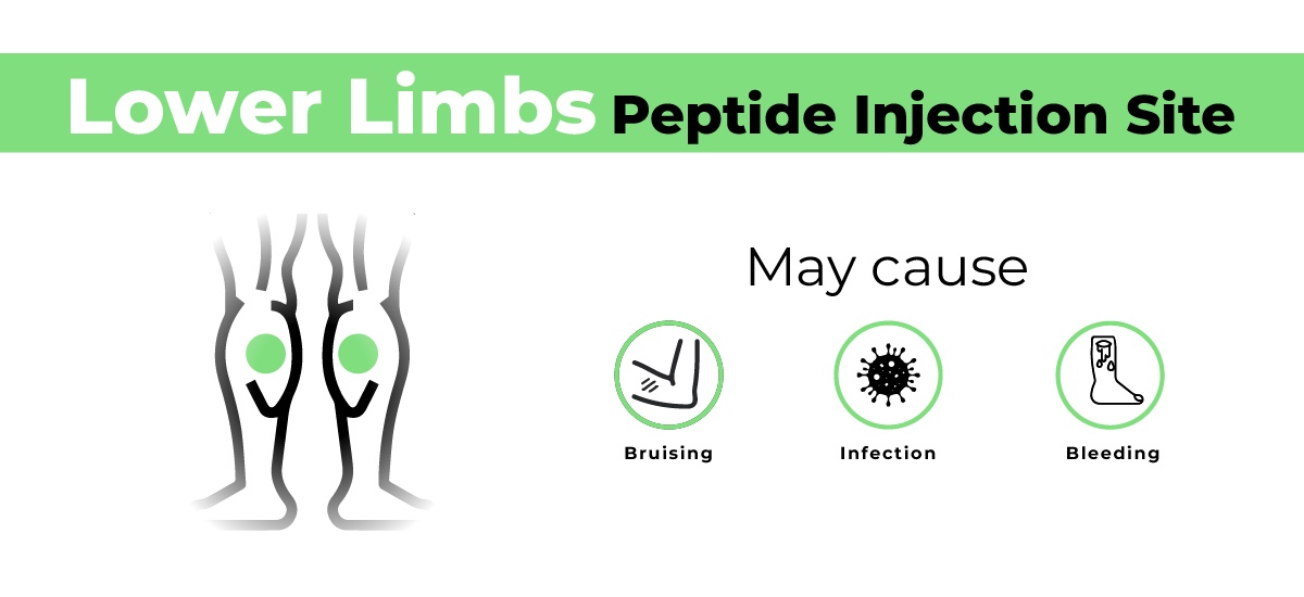 Peptide Injection Sites Full Guide On Where To Inject Peptides