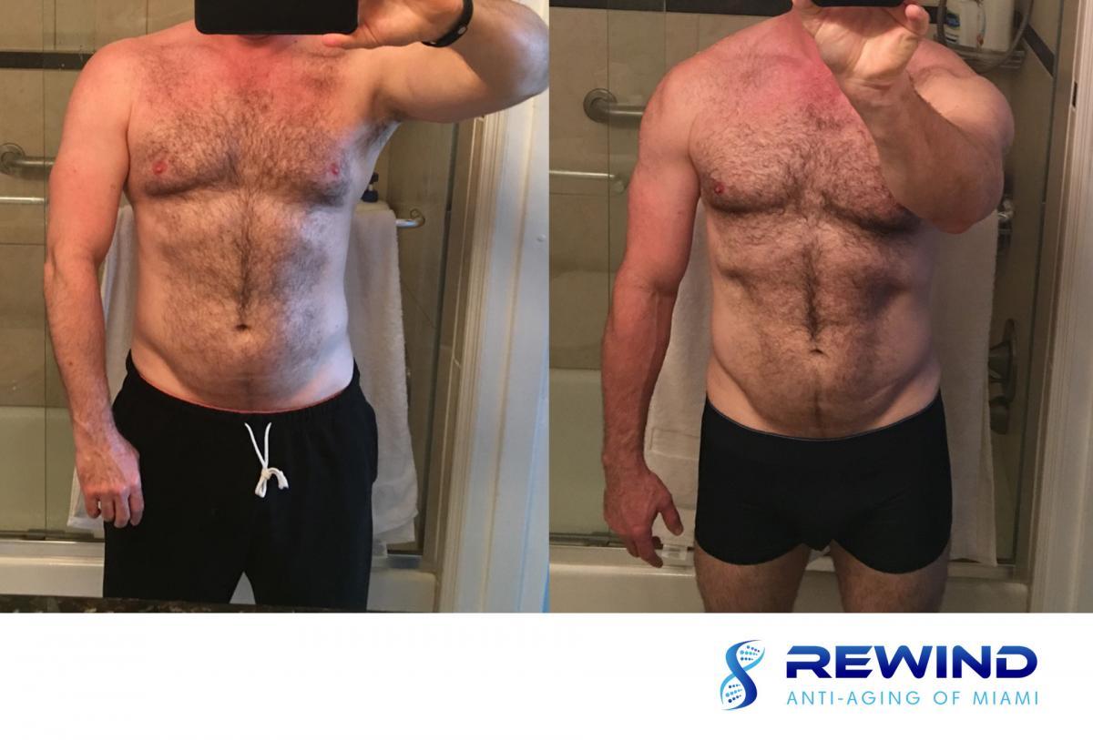 Peptide Therapy Reviews