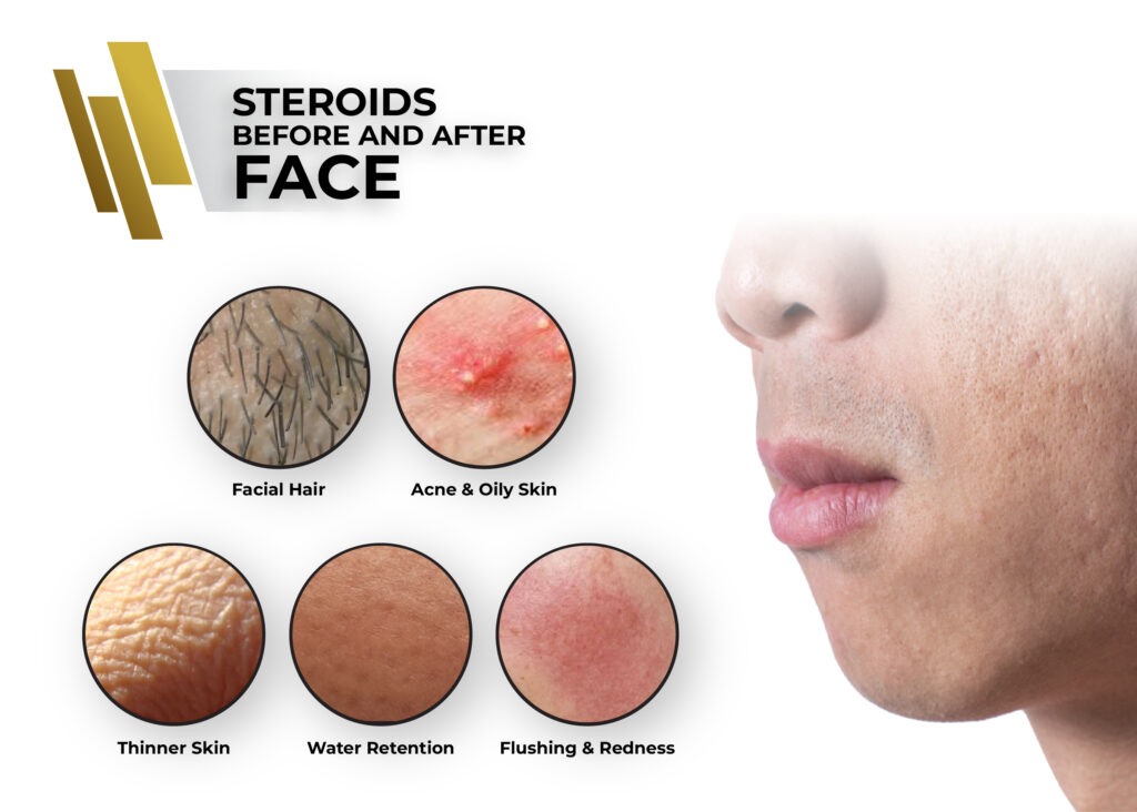 Skin issues on face before and after steroid use
